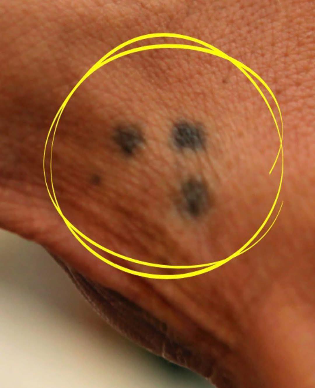 Wenn Sie jemanden mit einem Drei-Punkte-Tattoo auf der Hand sehen, ist Vorsicht geboten...
