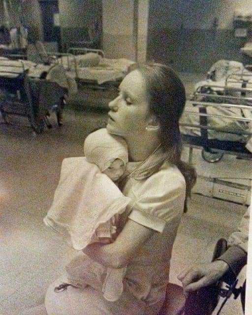 1977 Rettete eine Krankenschwester ein Schwer Verbranntes Baby